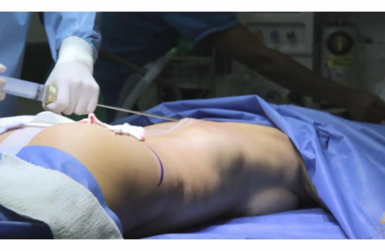 “La impunidad es la regla  por cirugías estéticas en Colombia”